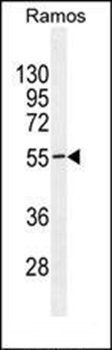 TSGA10IP antibody