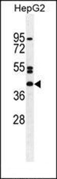 NT5DC4 antibody