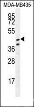 SAMD7 antibody