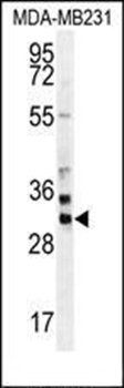ZNF321 antibody