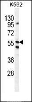 LRIT1 antibody