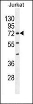 ZNF648 antibody