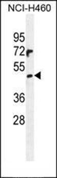 PRAMEF6 antibody