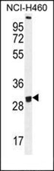 OR2B11 antibody