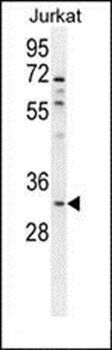 OR5B12 antibody