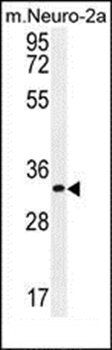 ZC3H8 antibody