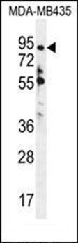 ZNF605 antibody