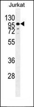 ZNF841 antibody