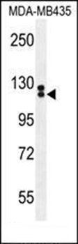TTLL13 antibody