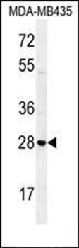 STX19 antibody