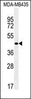 ZNF625 antibody