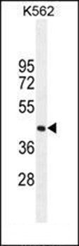 SIGLEC15 antibody