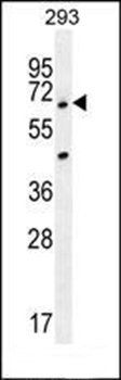 ANKRD34B antibody