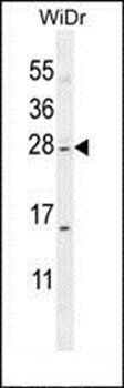 IQCF1 antibody