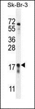 CA115 antibody