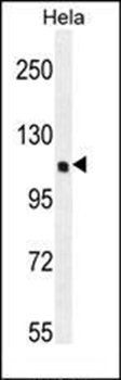 KIAA0999 antibody