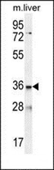 LDLRAD3 antibody