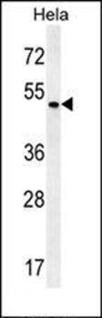 ZMYND17 antibody