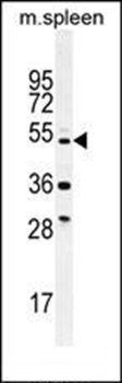 TTC23L antibody