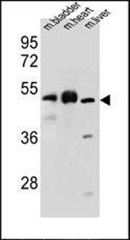 BTBD17 antibody