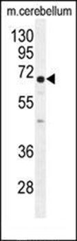 UGT8 antibody