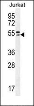 TRIM59 antibody