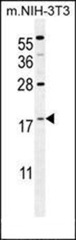 S100A4 antibody