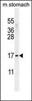 ZNF428 antibody