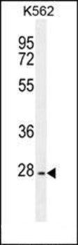 PTPN20A antibody