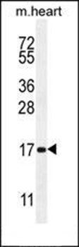SPACA5 antibody