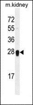 ARL5C antibody