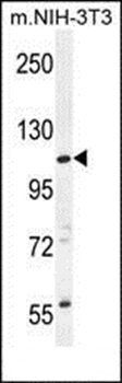 CCDC158 antibody