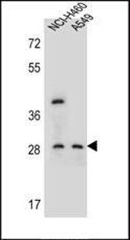 SPATS1 antibody