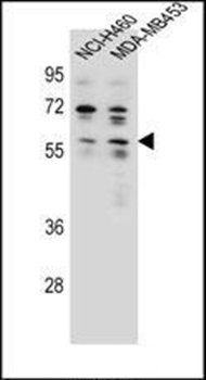 ANKRD34C antibody