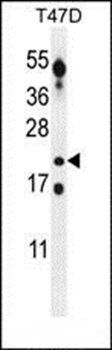 CT45A3 antibody