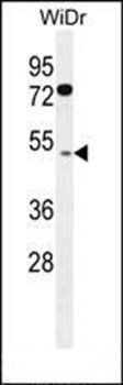 RMD1 antibody