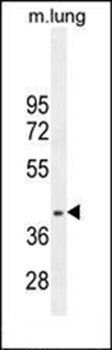 RNF215 antibody