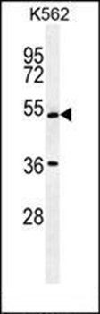 UAP1L1 antibody