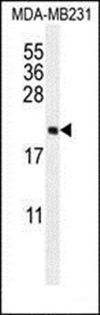 UNQ3104 antibody