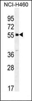 SHISA6 antibody