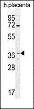 OR2AT4 antibody