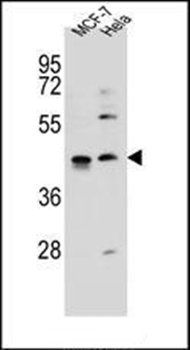 ZNF384 antibody