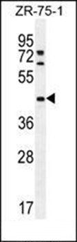 METTL2 antibody