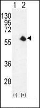 CDK8 antibody