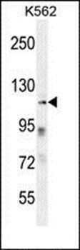 ZNF99 antibody