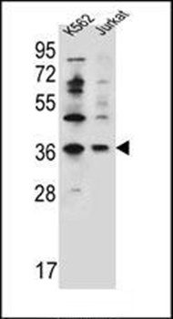 PPP1R3G antibody