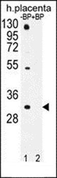 OR1D5 antibody
