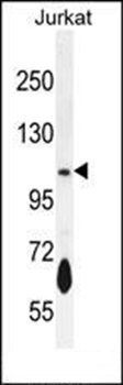 PDE3B antibody