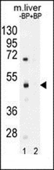 SAMD8 antibody