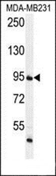 FTSJ3 antibody